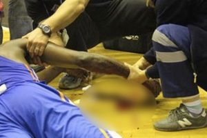 Kesilen bileği i&ccedil;in 38 bin TL'lik dava a&ccedil;tı