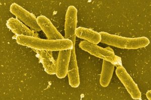 Bu bakteriye dikkat: Salmonella nedir?