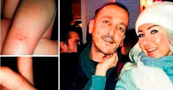 Medyatik g&uuml;zelden sevgiliye şiddet davası...
