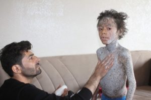 K&uuml;&ccedil;&uuml;k Melih yardım bekliyor