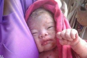 14 kez bı&ccedil;aklanıp ormana g&ouml;m&uuml;len bebek sağ bulundu