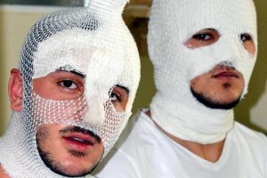 Parf&uuml;m sıktıkları otomobilin i&ccedil;inde yandılar