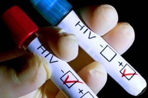 K&uuml;ba'da devrim gibi 'HIV' buluşu!