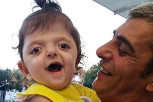 Bursa'da 22 aylık bebek 3 hastaya hayat ışığı oldu