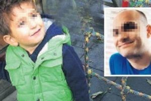 Y&uuml;z&uuml;ne asit atılan &ccedil;ocuk 100 ameliyat ge&ccedil;irdi, g&ouml;zleri artık g&ouml;rm&uuml;yor!