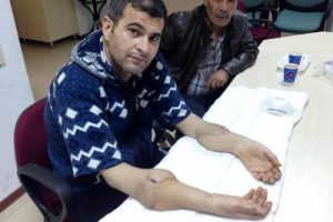 &Ccedil;ift kol nakilli Mustafa Sağır: Mucizeyi yaşıyorum