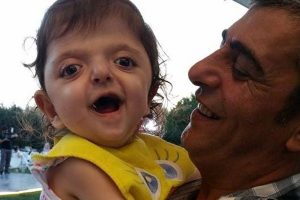 Bursalı Minik Mira 2 &ccedil;ocuğa umut oldu
