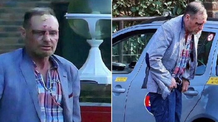 D&uuml;nya yıldızı kan revan! Şok g&ouml;r&uuml;nt&uuml;!