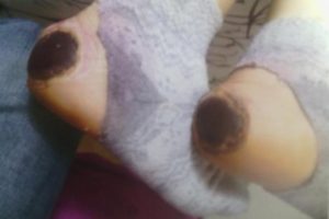 Doğumda topuk yakan ihmale su&ccedil; duyurusu