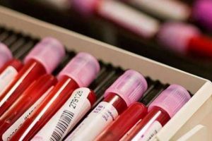 İngiltere'yi sarsan doping iddiası!