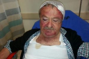 Ak Partili Başkanı su&ccedil;layan MHP'li meclis &uuml;yesi d&ouml;v&uuml;ld&uuml;