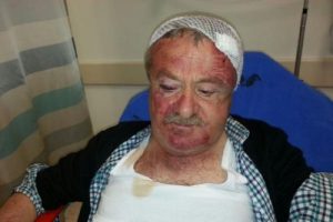 MHP'li meclis &uuml;yesini, Ak Partili başkanın kardeşleri d&ouml;vm&uuml;ş