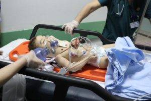 Babasının kucağındayken 2. kattan d&uuml;şen bebek ağır yaralandı
