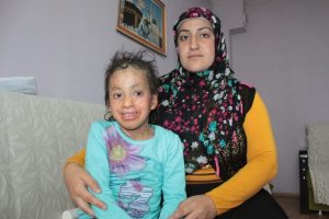 Bursa'da balık derisi hastalığına yakalanan Azra yardım bekliyor