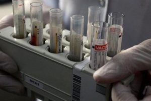 Hepatit B tarihe karışacak