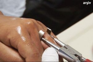 Parmağına sıkışan y&uuml;z&uuml;kten itfaiye ekipleri kurtardı