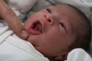 Minik bebek 2 dişle doğdu, doktorlar şaşırdı
