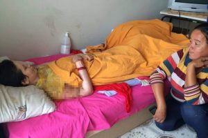 Kezzapla yakılan kadının en b&uuml;y&uuml;k isteği 'sarılmak'