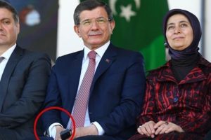 Davutoğlu'nun elindeki bandajın sırrı &ccedil;&ouml;z&uuml;ld&uuml;