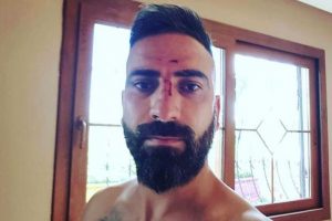 8 kişiyi d&ouml;vd&uuml;, vicdana gelip ziyaret etti