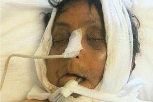 Torunun d&ouml;vd&uuml;ğ&uuml; anneanne 14 g&uuml;n sonra &ouml;ld&uuml;