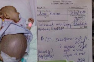 Miray bebek i&ccedil;in umut ışığı doğdu