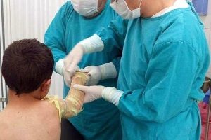 &Ccedil;akmakla oynayan &ccedil;ocuk, kendini yaktı