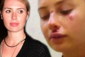 Chloe Loughnan dayak mı yedi?
