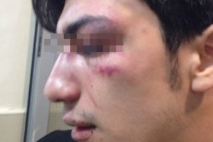 Dar&uuml;şşafaka'da feci dayak mahkemelik oldu