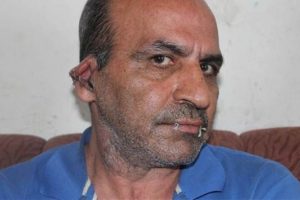 İranlı sığınmacı ağzını ve kulaklarını dikti
