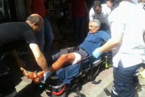 Yan baktığı i&ccedil;in bacağından bı&ccedil;akladı