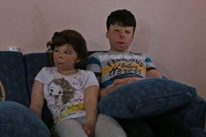 Suriyeli kardeşler ellerine kavuşmak istiyor!