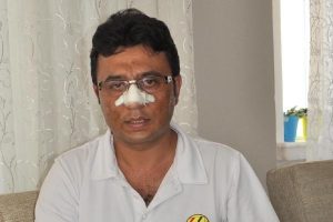 Sendika başkanına 'Burun kırma' su&ccedil;laması