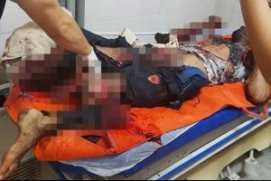 Patlayıcı hazırlarken &ouml;len 2 Suriyelinin &ouml;rg&uuml;t bağlantısı araştırılıyor