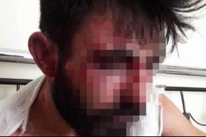 Kadınlar istismarcıyı d&ouml;v&uuml;p teşhir etti