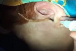 Kulağından kırkayak &ccedil;ıktı