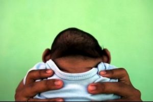 İspanya'da ilk mikrosefali bebek doğdu