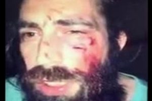 'T&uuml;rk bayrağı tutmadığı' gerek&ccedil;esiyle darp edilmişti: 'Fransız değil Yozgatlıyım'