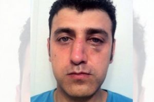 T&uuml;rk&ccedil;e konuştuğu i&ccedil;in yumruklandı!