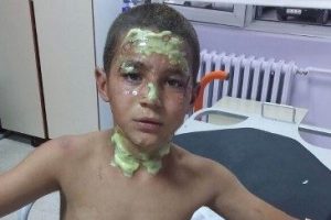 &Ccedil;akmak gazı patlayınca 3 &ccedil;ocuk yaralandı