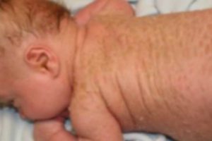 Siirt'te 'yılan bebek' d&uuml;nyaya geldi