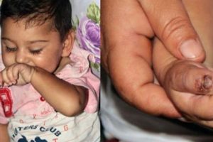 Isırarak kendine zarar veren bebeğin ailesi yardım istedi