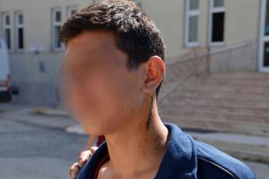 14 yaşındaki &ccedil;ırağını demirle d&ouml;vd&uuml;