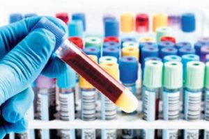 Tek bir belirti yokken kanseri anlayan test!