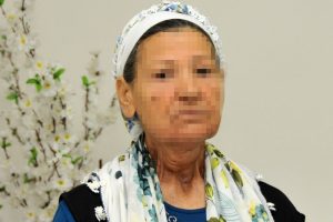 Dilin yerine doku nakledildi: 1 yılda konuşmaya başladı