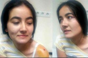 Bah&ccedil;ede oturan gen&ccedil; kıza kurşun isabet etti