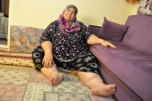 Eşi &ouml;l&uuml;nce hayata k&uuml;st&uuml;, 180 kilo oldu