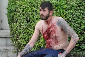 Bunalıma girip kendini yaraladı