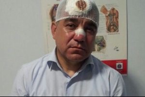 Gezi'de vekilin burnunu kıran polisin cezası belli oldu