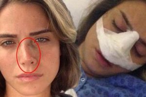 Ceyda Ateş'in burnu yamulmuş!